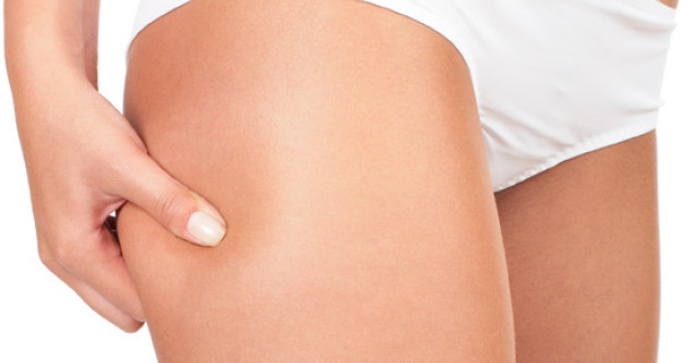 5 Tratamente naturiste care te scapa de VERGETURI