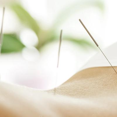 Ce fel de probleme de sănătate pot fi rezolvate sau ameliorate prin acupunctură