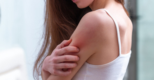 Psoriazis: Simptome și tratament 