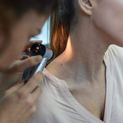 8 semne că ai nevoie de o programare la medicul dermatolog