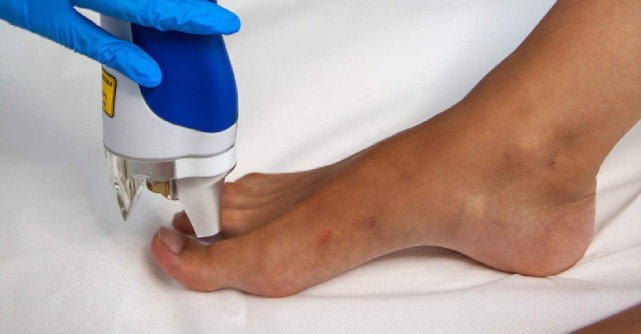 Doctor Adelina Dianu, Medic Specialist Dermatologie, AVRA Aesthetic Institute, despre tratamentul cu laser al onicomicozei 