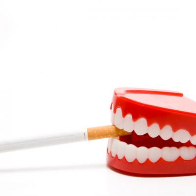 Cancerul oral: cauze, simptome si tratamente