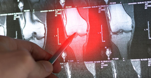 Primele semne ale cancerului osos: simptome pe care nu ar trebui să le ignori 