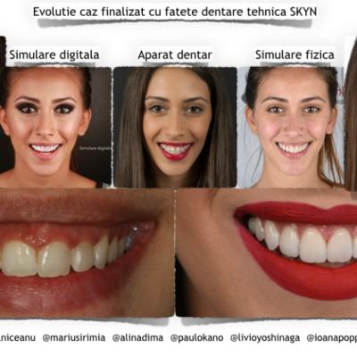 Estetica dentara in timp real, inovatie stomatologica la Neoclinique