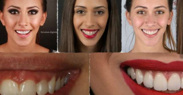 Estetica dentara in timp real, inovatie stomatologica la Neoclinique