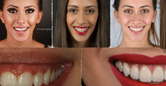 Estetica dentara in timp real, inovatie stomatologica la Neoclinique