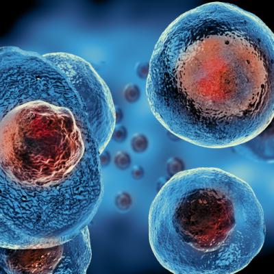 Eficiența celulelor stem în lupta cu boala Lupus