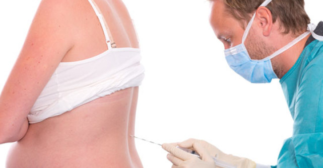 Cum te ajuta epidurala la nastere