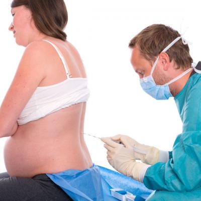 Cum te ajuta epidurala la nastere