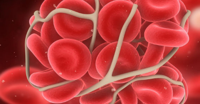 TEV - a treia boala cardiovasculara ca incidenta