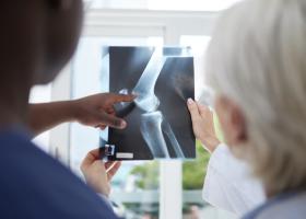 Dacă nu ți-ai rupt niciodată niciun os, există o teorie a conspirației ciudată la care ar trebui să fii atent