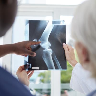 Dacă nu ți-ai rupt niciodată niciun os, există o teorie a conspirației ciudată la care ar trebui să fii atent