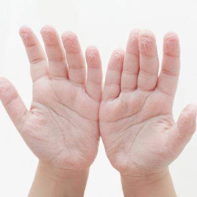  Ciudatenii care te protejeaza: 9 Mecanisme de aparare ale corpului omenesc