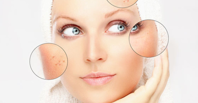 Produse BIO de tratare si ingrijire pentru tenul cuperozic