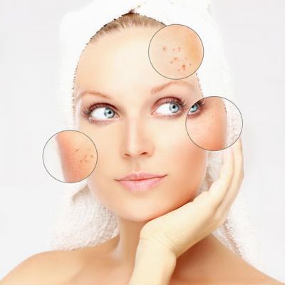 Produse BIO de tratare si ingrijire pentru tenul cuperozic