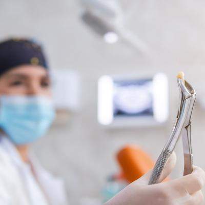 Extracția dentară: sfaturi post-operatorii esențiale pentru o recuperare rapidă 