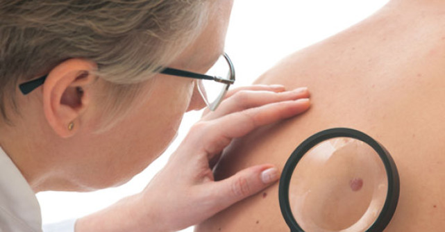 Afla daca ai ALUNITE CANCERIGENE: testari gratuite