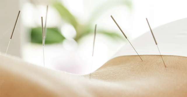 Ce fel de probleme de sănătate pot fi rezolvate sau ameliorate prin acupunctură