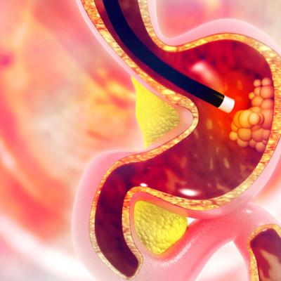 Endoscopia digestivă superioară și colonoscopia: metode de screening, diagnostic și tratament