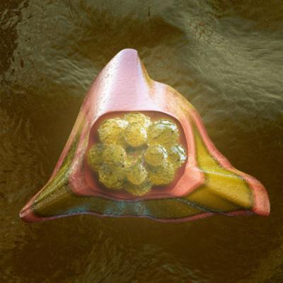 SOCANT: Medicii 'omoara' CANCERUL cu o banala RACEALA