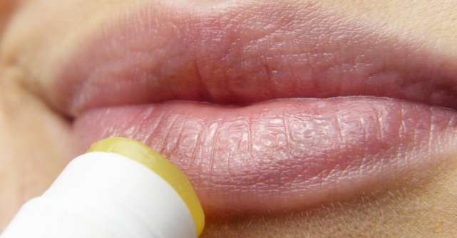 De ce ai tot timpul buzele crăpate și cum le poți vindeca rapid