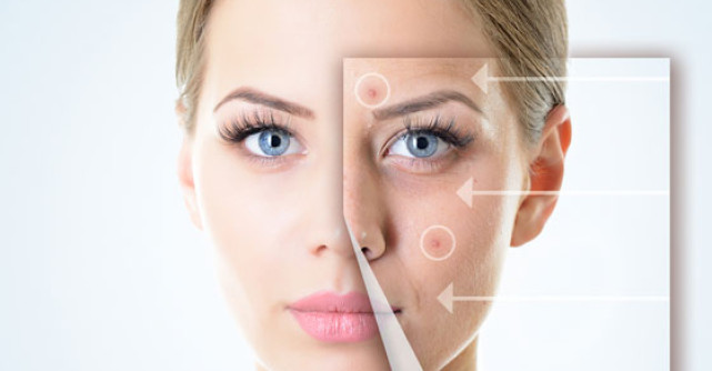 Scapa de ACNEE: 5 Produse recomandate in ingrijirea zilnica