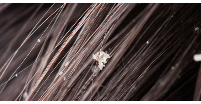 Pont! Cum scapi de matreata