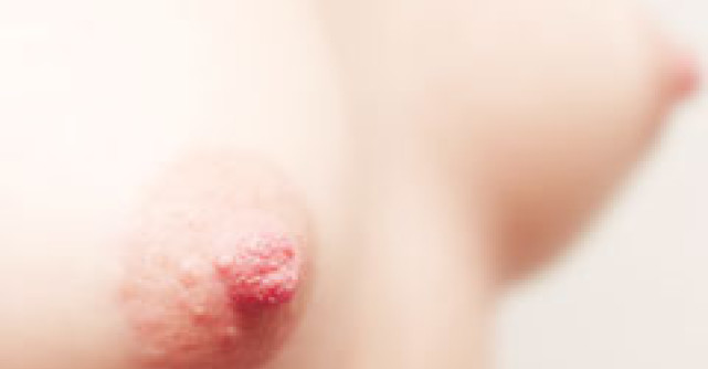 Exercitii pentru ridicarea si marirea sanilor