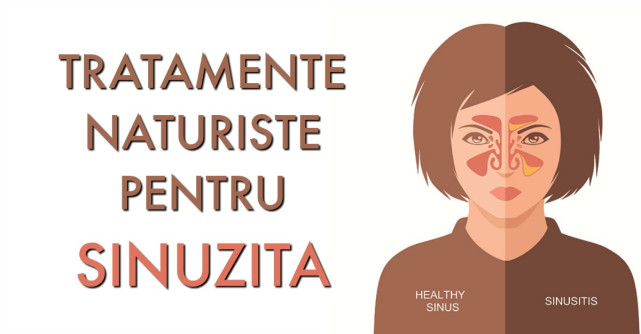 Tratamente Naturiste pentru SINUZITA: cum sa te tratezi acasa
