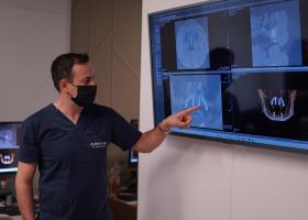 Premieră la Clinica 32. Primele implanturi Neodent ZiR, inserate cu succes prin ghidaj digital, fără tăieturi
