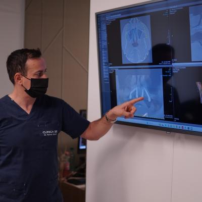 Premieră la Clinica 32. Primele implanturi Neodent ZiR, inserate cu succes prin ghidaj digital, fără tăieturi