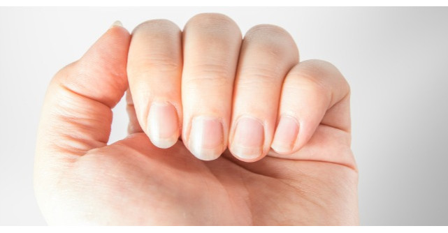 5 lucruri pe care unghiile le spun despre sanatatea ta