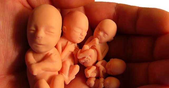 Noua Lege a Avortului 