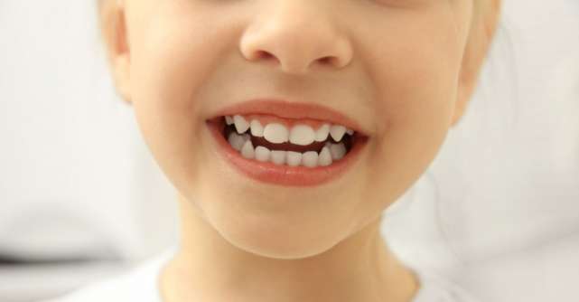 Cariile copiilor: de ce se tratează dacă tot sunt dinți de lapte și îi schimbă?
