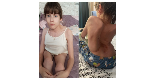Ajut-o pe Maria să meargă mai departe! Mama ei cere sprijin pentru o operație vitală care îi poate salva viața
