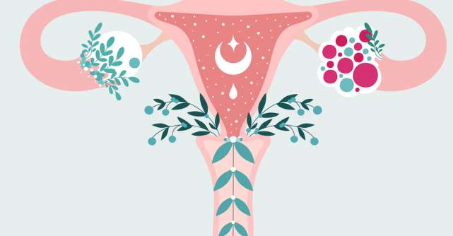 Torsiunea ovariană: cauze și tratament