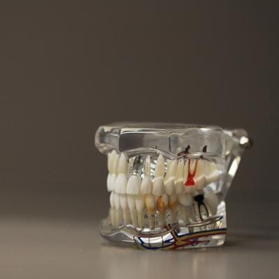 Protezele dentare second hand – o gluma proasta?