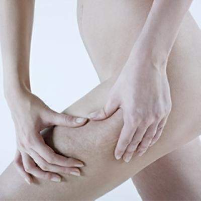 Dermoingrijirea anticelulitica