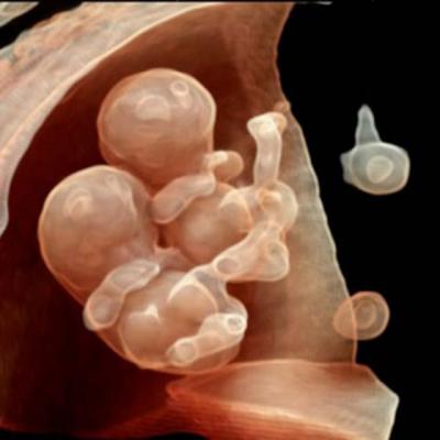 Super-tehnologia prin care iti vezi copilul 4D inainte de nastere