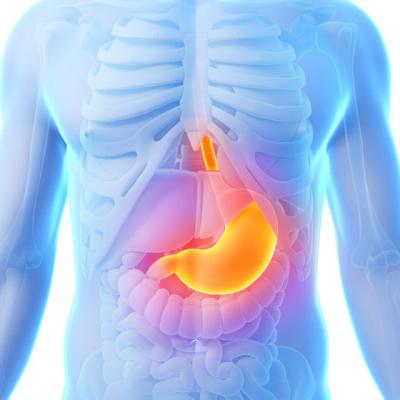 Operatia de micsorare a stomacului - mituri si adevaruri