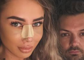 Maria Avram, primele imagini după operația la nas. Fosta concurentă de la Insula Iubirii a explicat motivul intervenției