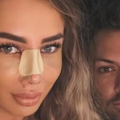 Maria Avram, primele imagini după operația la nas. Fosta concurentă de la Insula Iubirii a explicat motivul intervenției