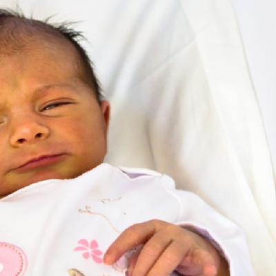 Icterul neonatal: ce este, cauze, simptome și tratament