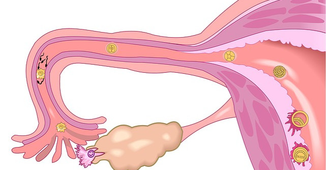 Colposcopia si biopsia cervicala: cand sunt indicate