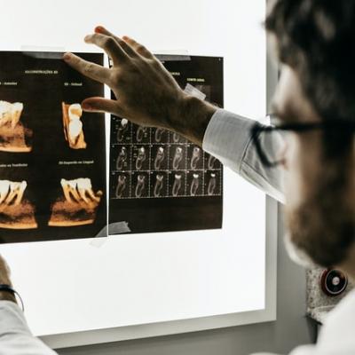 Măseaua de minte și povestea ei delicată