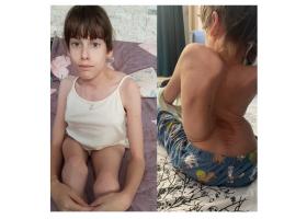 Ajută-o pe Maria să meargă mai departe! Mama ei cere sprijin pentru o operație vitală care îi poate salva viața