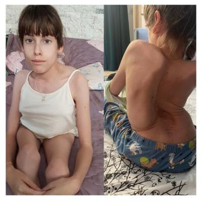 Ajut-o pe Maria să meargă mai departe! Mama ei cere sprijin pentru o operație vitală care îi poate salva viața