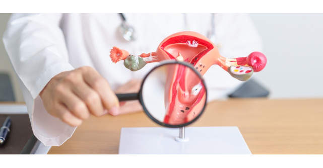 Cum se diagnostichează endometrioza: 7 investigații și teste recomandate 