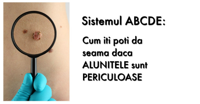 Sistemul ABCDE: Cum iti poti da seama daca ALUNITELE sunt PERICULOASE