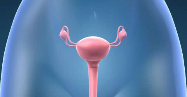 Fibromul uterin - afla, discuta, decide! 